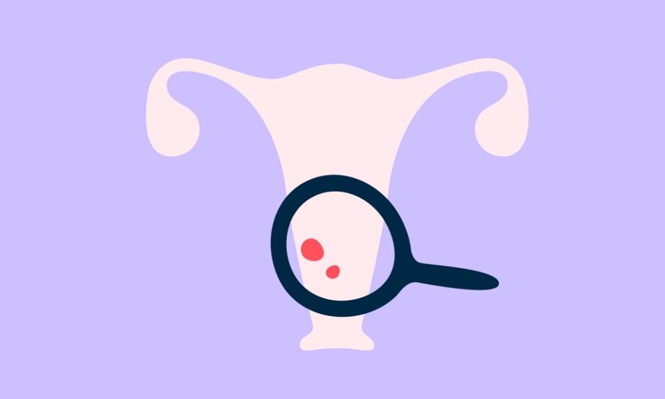 Les cancers touchent de plus en plus de personnes, mais une meilleure information peut faire toute la différence. Quels sont les facteurs de risque ? Comment les prévenir et les détecter à temps ?