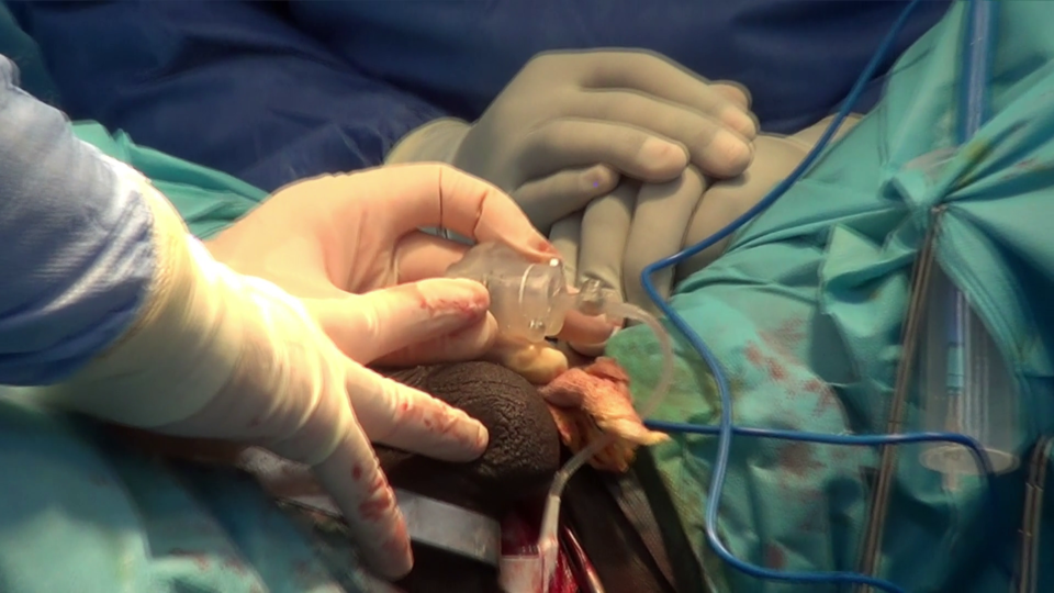 Souffrez-vous des troubles d’érection? Dans ce numéro de “Santé en ligne” animée par Angela Kpeidja, Professeur Magloire Yèvi, urologue-andrologue en service  Centre Hospitalier Universitaire Départemental de l'Ouémé et du Plateau, partage son savoir et dévoile les avancées médicales qui redonnent espoir. 