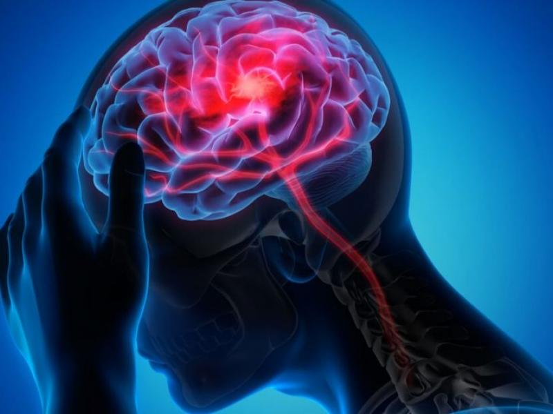 L'épilepsie touche environ 50 millions de personnes à travers le monde, selon l'Organisation mondiale de la santé (OMS). Bien qu'elle figure parmi les maladies neurologiques les plus courantes, elle reste largement méconnue et entourée de préjugés, en particulier en Afrique. Cette stigmatisation constitue un frein majeur à une prise en charge adéquate des patients.