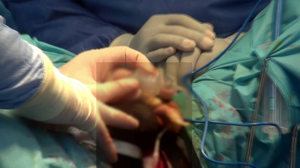 Santé sexuelle et urinaire : une mission chirurgicale internationale annoncée à Porto-Novo